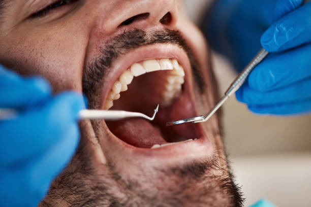 Best Broken Tooth Emergency  in Van Wert, OH